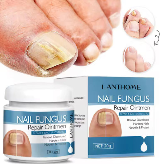 Crème Anti-Mycose Ongulaire – Résultats Rapides
