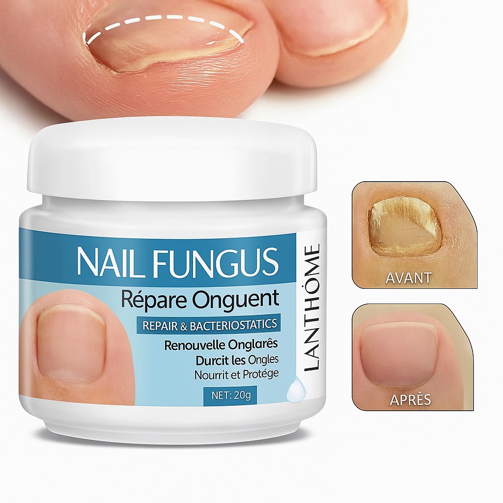 Crème Anti-Mycose Ongulaire – Résultats Rapides
